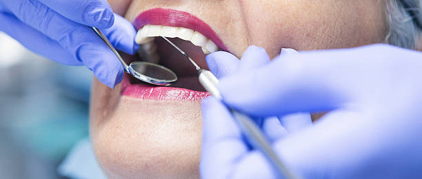 Best Emergency Orthodontic Services in Veedersburg, IN